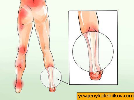 kaalulangus jalgade sumptomite