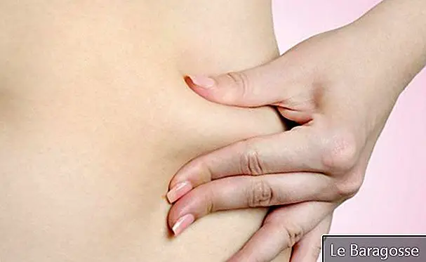 ennetavat naha ennetamise kaalulanguse ajal ultra kiire rasva kadu